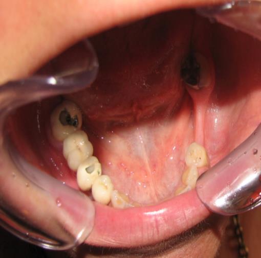 Implantology