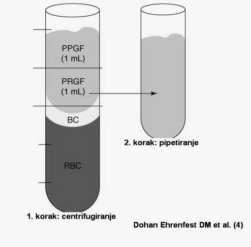 Krvni pripravki