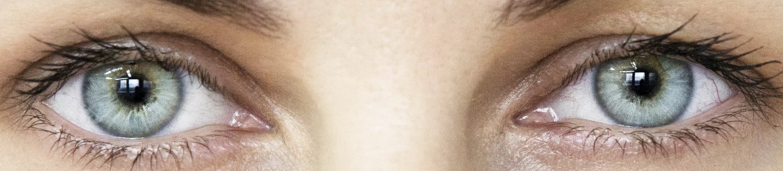 Korekcija povešenih vek - blefaroplastika